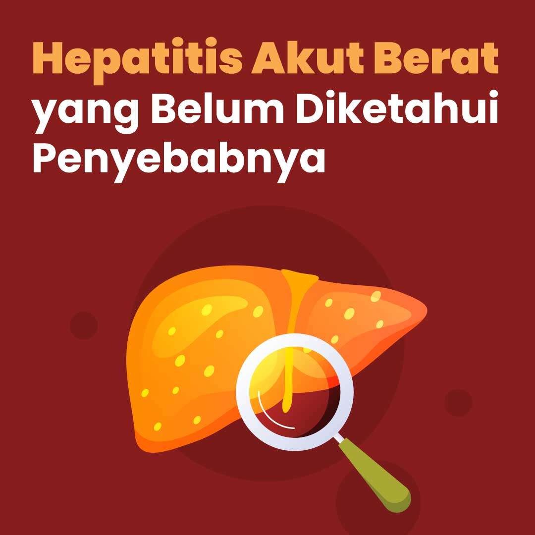 Hepatitis Akut Berat yang Belum Diketahui Penyebabnya
