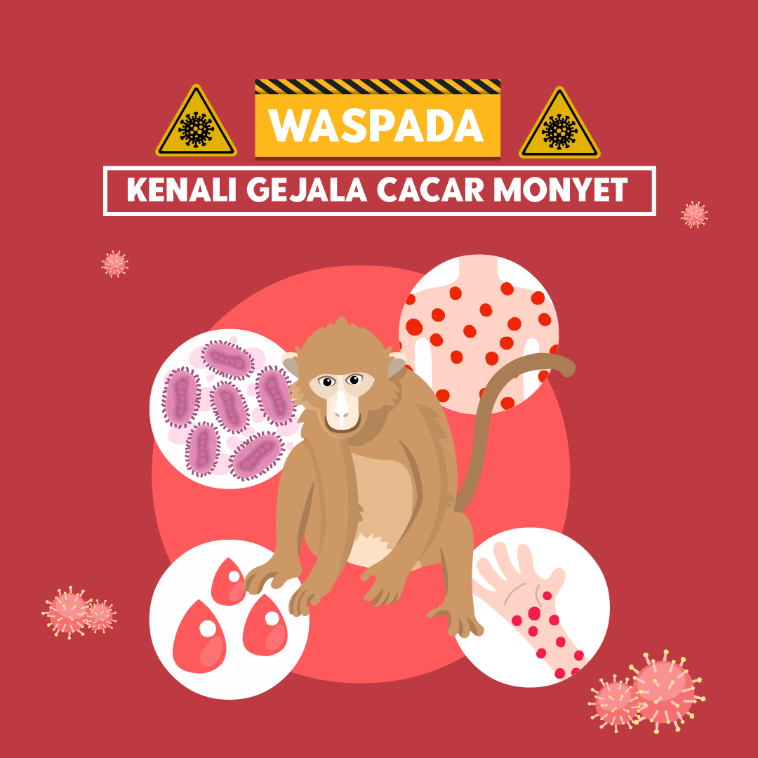 Waspada! Kenali Gejala cacar Monyet