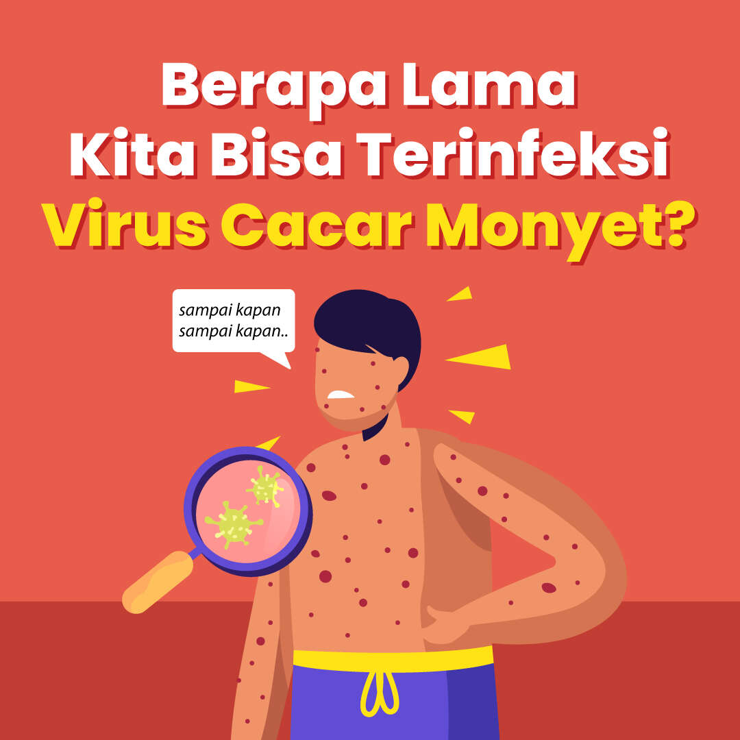 Berapa Lama Kita Bisa Terinfeksi Virus Cacar Monyet?