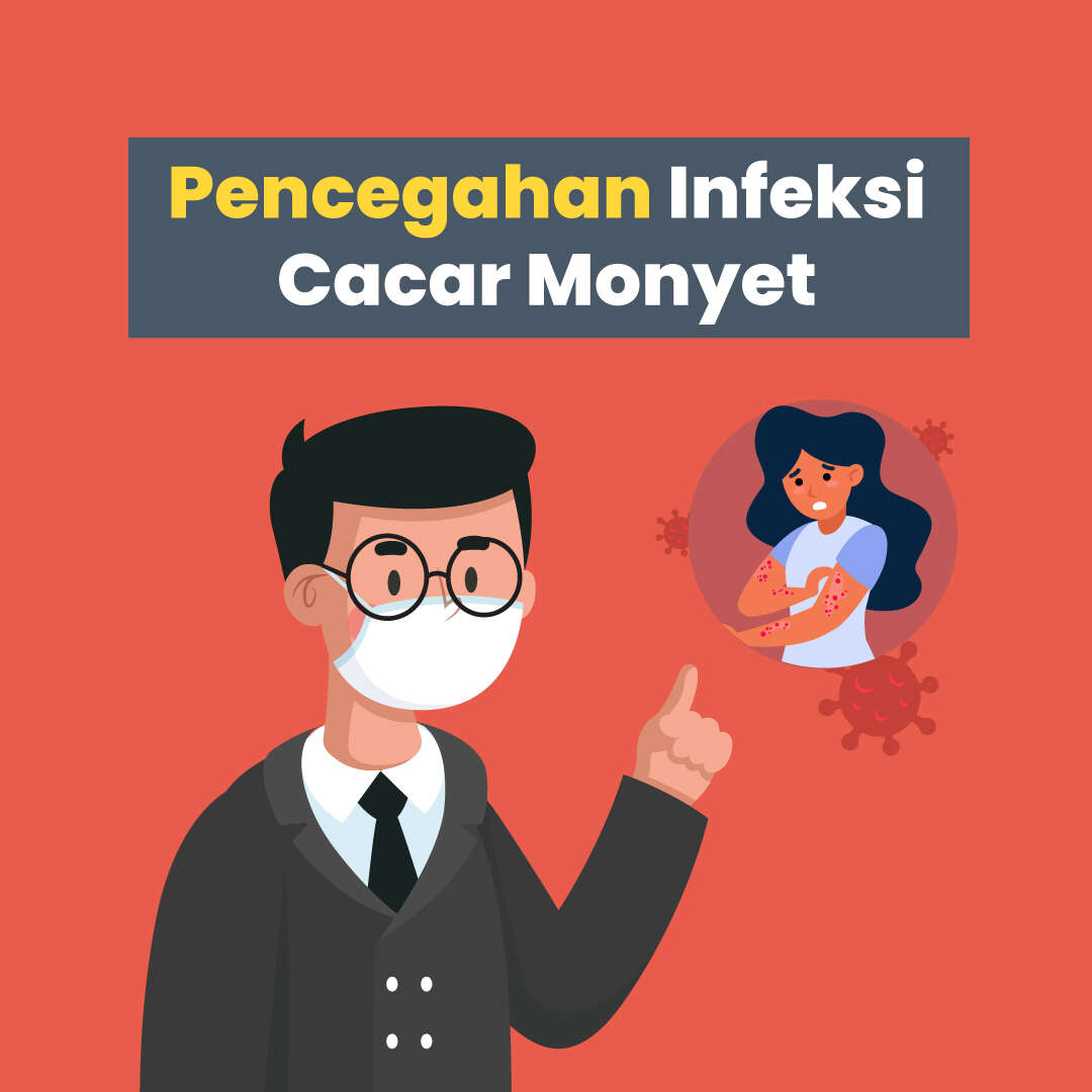 Pencegahan Infeksi Cacar Monyet 